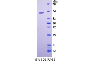 SDS-PAGE analysis of Rat Pepsinogen C Protein.