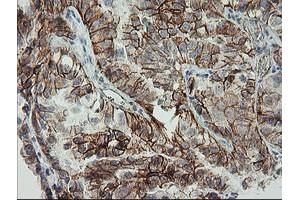 Immunohistochemistry (IHC) image for anti-Cadherin 2 (CDH2) antibody (ABIN1499625) (N-Cadherin Antikörper)