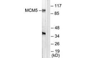 Western blot analysis of extracts from HepG2 cells, using MCM5 Antibody. (MCM5 Antikörper  (AA 21-70))