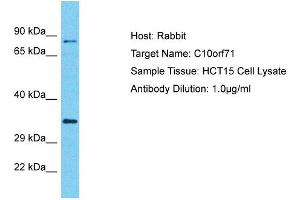 Host: Rabbit Target Name: C10orf71 Sample Type: HCT15 Whole cell lysates Antibody Dilution: 1. (C10ORF71 Antikörper  (C-Term))