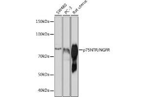 Western blot analysis of extracts of various cell lines, using p75NTR/NGFR antibody (ABIN7268850) at 1:1000 dilution. (NGFR Antikörper)