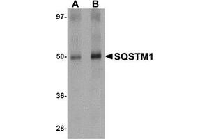 AP20066PU-N SQSTM1 antibody staining of Human Spleen Tissue Lysate by Western Blotting at (A) 1 and (B) 2 μg/ml.