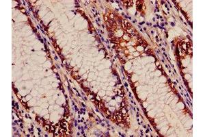 Immunohistochemistry (IHC) image for anti-N-Acylaminoacyl-Peptide Hydrolase (APEH) (AA 201-500) antibody (ABIN7143250)