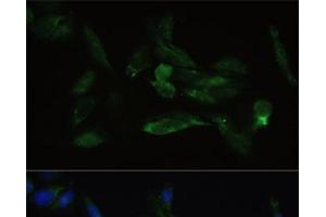 Immunofluorescence analysis of U2OS cells using TGFBR2 Polyclonal Antibody at dilution of 1:100. (TGFBR2 Antikörper)