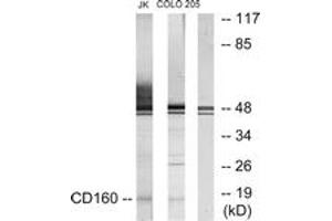 Western blot analysis of extracts from Jurkat/COLO205 cells, using CD160 Antibody.