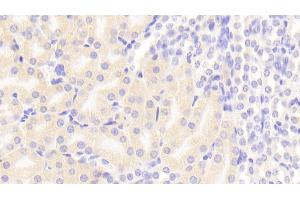 Detection of FADD in Mouse Kidney Tissue using Polyclonal Antibody to Fas Associating Death Domain Containing Protein (FADD) (FADD Antikörper  (AA 7-178))