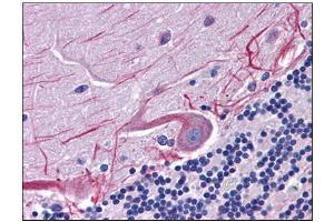 Human Brain, Cerebellum: Formalin-Fixed, Paraffin-Embedded (FFPE) (SKA1 Antikörper  (C-Term))