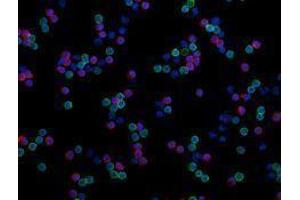 Immunofluorescence (IF) image for anti-CD8a Molecule (CD8A) antibody (Alexa Fluor 594) (ABIN2656837) (CD8 alpha Antikörper  (Alexa Fluor 594))