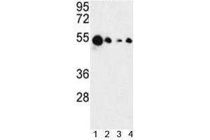 Western blot analysis of AIM2 antibody and 1) MCF-7, 2) HL-60, 3) K562 and 4) HeLa lysate. (AIM2 Antikörper  (AA 1-50))