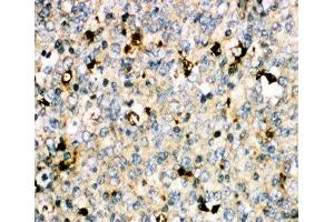 IHC-P: MyD88 antibody testing of human tonsil tissue (MYD88 Antikörper  (Middle Region))