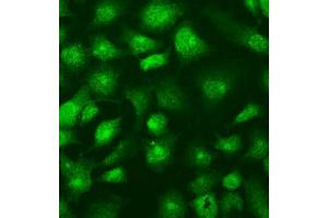 IF analysis of SUFU using anti-SUFU antibody (ABIN7601394).