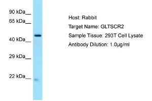 Host: RabbitTarget Name: GLTSCR2Antibody Dilution: 1. (GLTSCR2 Antikörper  (C-Term))