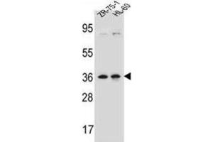 Western Blotting (WB) image for anti-Leucine Zipper Protein 2 (LUZP2) antibody (ABIN2997192)