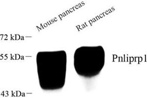 Western blot analysis of Pnliprp1 (ABIN7074981) at dilution of 1: 1000 (PNLIPRP1 Antikörper)