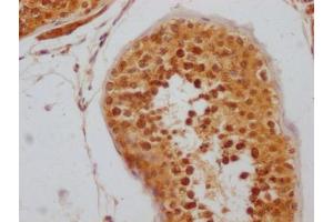 IHC image of ABIN7127796 diluted at 1:100 and staining in paraffin-embedded human testis tissue performed on a Leica BondTM system. (Rekombinanter RNF2 Antikörper)