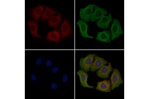 ABIN6260771 and ABIN6279279 staining Hela cells by IF/ICC. (CEP72 Antikörper)