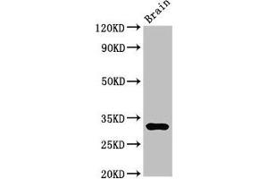 Western Blot Positive WB detected in: Mouse brain tissue All lanes: DNASE1 antibody at 3 μg/mL Secondary Goat polyclonal to rabbit IgG at 1/50000 dilution Predicted band size: 32, 20 kDa Observed band size: 32 kDa (DNASE1 Antikörper  (AA 78-231))