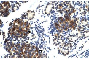 Human Pancreas; TRIM41 antibody - C-terminal region in Human Pancreas cells using Immunohistochemistry