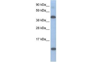 WB Suggested Anti-A630025C20RIK Antibody Titration:  0. (Lcor Antikörper  (N-Term))