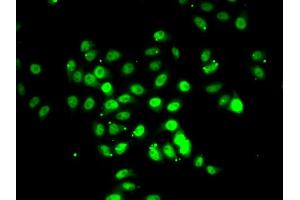 Immunofluorescence analysis of U2OS cells using RFX5 antibody (ABIN5974192). (RFX5 Antikörper)