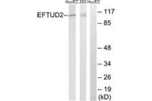 Western blot analysis of extracts from 293/HuvEc cells, using EFTUD2 Antibody. (EFTUD2 Antikörper  (AA 321-370))