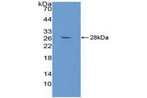 Western blot analysis of recombinant Human aZGP1. (AZGP1 Antikörper)