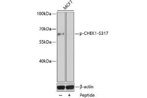 Western blot analysis of extracts of MCF7 cell line using Phospho-CHEK1(S317) Polyclonal Antibody. (CHEK1 Antikörper  (pSer317))