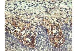 Immunohistochemistry staining of tonsil (paraffin-embedded sections) with anti-human Tenascin (T2H5). (TNC Antikörper)