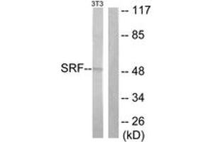 Western blot analysis of extracts from NIH-3T3 cells, treated with PMA 125ng/ml 30', using SRF (Ab-99) Antibody. (SRF Antikörper  (AA 71-120))