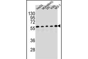 X1 Antibody (C-term) (ABIN654415 and ABIN2844152) western blot analysis in HepG2,MDA-M,293,K562,MCF-7 cell line lysates (35 μg/lane). (PAX1 Antikörper  (C-Term))