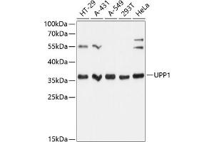 Western blot analysis of extracts of various cell lines, using UPP1 Antibody (ABIN6128903, ABIN6149952, ABIN6149953 and ABIN6216895) at 1:3000 dilution. (UPP1 Antikörper  (AA 89-173))