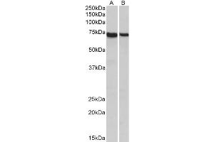 ABIN2613455 (1µg/ml) staining of Mouse (A) and Rat (B) Spleen lysates (35µg protein in RIPA buffer). (STXBP3 Antikörper  (Internal Region))