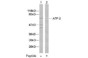 Image no. 2 for anti-Activating Transcription Factor 2 (ATF2) (Ser112), (Ser94) antibody (ABIN197152) (ATF2 Antikörper  (Ser94, Ser112))