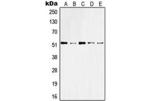 Western blot analysis of Cytokeratin 10 expression in HeLa (A), A431 (B), Raw264. (Keratin 10 Antikörper  (Center))