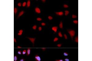 Immunofluorescence analysis of MCF-7 cells using Phospho-ABL1(Y204) Polyclonal Antibody (ABL1 Antikörper  (pTyr204))