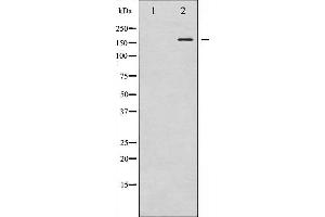 Western blot analysis of VEGFR2 phosphorylation expression in Na3VO4 treated HepG2 whole cell lysates,The lane on the left is treated with the antigen-specific peptide. (VEGFR2/CD309 Antikörper  (pTyr1059))