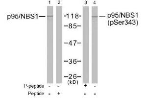 Image no. 2 for anti-Nibrin (NBN) (Ser343) antibody (ABIN197201) (Nibrin Antikörper  (Ser343))