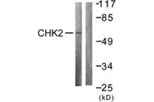 Western blot analysis of extracts from COS7 cells treated with UV 30', using Chk2 (Ab-383) Antibody. (CHEK2 Antikörper  (AA 356-405))