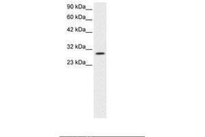 Image no. 3 for anti-Jumonji Domain Containing 8 (JMJD8) (AA 111-160) antibody (ABIN6735793) (JMJD8 Antikörper  (AA 111-160))