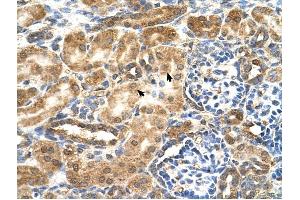 GCNT3 antibody was used for immunohistochemistry at a concentration of 4-8 ug/ml to stain EpitheliaI cells of renal tubule (arrows) in Human Kidney. (GCNT3 Antikörper)