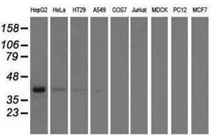 Image no. 3 for anti-3-hydroxyisobutyryl-CoA Hydrolase (HIBCH) antibody (ABIN1498655) (HIBCH Antikörper)