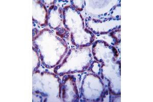 SLC22A1 Antibody immunohistochemistry analysis in formalin fixed and paraffin embedded human kidney tissue followed by peroxidase conjugation of the secondary antibody and DAB staining. (SLC22A1 Antikörper  (C-Term))