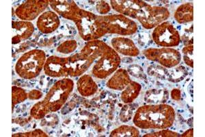 USH1C polyclonal antibody  (10 ug/mL) staining of paraffin embedded human kidney. (USH1C Antikörper)