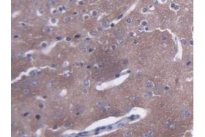Detection of AMPH in Mouse Cerebrum Tissue using Polyclonal Antibody to Amphiphysin (AMPH) (Amphiphysin Antikörper  (AA 24-240))
