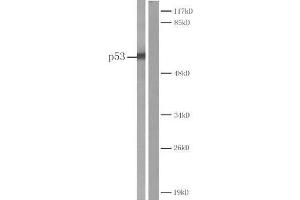 Western blot analysis of extracts from COS7 cells Left: Using P53 (Ab-20) antibody (E022030). (p53 Antikörper)