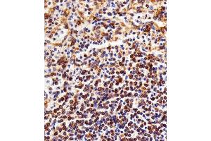 Immunohistochemistry (Paraffin-embedded Sections) (IHC (p)) image for anti-Nuclear Factor of kappa Light Polypeptide Gene Enhancer in B-Cells 1 (NFKB1) antibody (ABIN4912357)