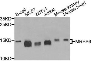 Western blot analysis of extracts of various cells, using MRPS6 antibody. (MRPS6 Antikörper)