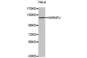 Western Blotting (WB) image for anti-Heterogeneous Nuclear Ribonucleoprotein U (Scaffold Attachment Factor A) (HNRNPU) (AA 608-825) antibody (ABIN6220424) (HNRNPU Antikörper  (AA 608-825))