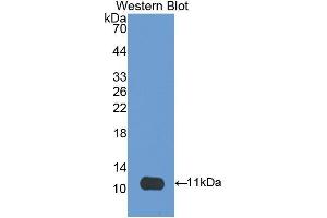 Western Blotting (WB) image for anti-CD3d Molecule, delta (CD3-TCR Complex) (CD3D) (AA 19-99) antibody (ABIN1175139) (CD3D Antikörper  (AA 19-99))