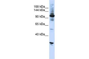 WB Suggested Anti-DIS3 Antibody Titration:  0.